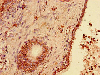 Immunofluorescent analysis of HepG2 cells using CAC09557 at dilution of 1:100 and Alexa Fluor 488-congugated AffiniPure Goat Anti-Rabbit IgG(H+L)