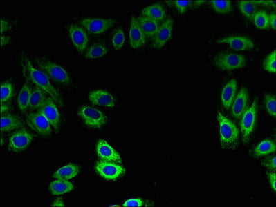 Immunohistochemistry of paraffin-embedded human colon cancer using CAC09568 at dilution of 1:100
