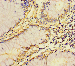 Zdhhc15 Polyclonal Antibody - image 3