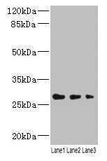 Lrrc57 Polyclonal Antibody - image 2