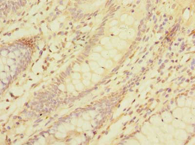 Immunohistochemistry of paraffin-embedded human colon tissue using CAC09586 at dilution of 1:100