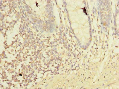 Lmo3 Polyclonal Antibody - image 4