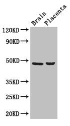 Immunohistochemistry of paraffin-embedded human liver cancer using CAC09639 at dilution of 1:100