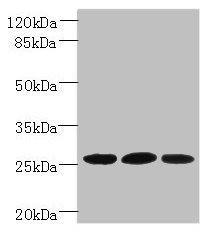 Immunohistochemistry of paraffin-embedded human prostate cancer using CAC09643 at dilution of 1:100