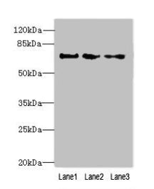 Immunohistochemistry of paraffin-embedded human bladder cancer using CAC09644 at dilution of 1:100