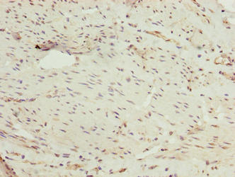 Ppil4 Polyclonal Antibody - image 3