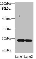 Immunofluorescent analysis of U251 cells using CAC09655 at dilution of 1:100 and Alexa Fluor 488-congugated AffiniPure Goat Anti-Rabbit IgG(H+L)