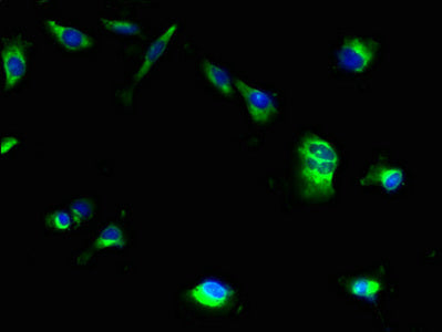 Immunohistochemistry of paraffin-embedded human lung tissue using CAC09655 at dilution of 1:100