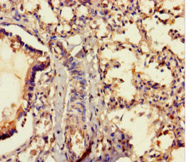 Immunohistochemistry of paraffin-embedded human brain tissue using CAC09655 at dilution of 1:100