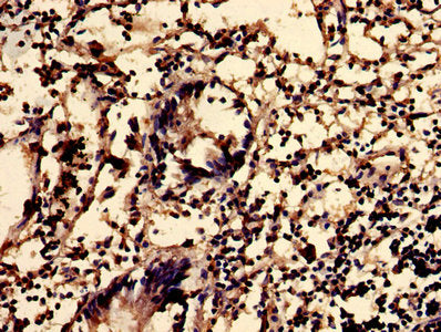 Immunofluorescence staining of Hela cells with CAC09667 at 1:200, counter-stained with DAPI. The cells were fixed in 4% formaldehyde, permeabilized using 0.2% Triton X-100 and blocked in 10% normal Goat Serum. The cells were then incubated with the antibody overnight at 4°C. The secondary antibody was Alexa Fluor 488-congugated AffiniPure Goat Anti-Rabbit IgG(H+L).