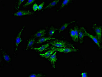 Sgms2 Polyclonal Antibody - image 4
