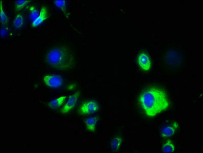 Western Blot; ,Positive WB detected in: K562 whole cell lysate, SH-SY5Y whole cell lysate; ,All lanes: GPA33 antibody at 3.2µg/ml; ,Secondary; ,Goat polyclonal to rabbit IgG at 1/50000 dilution; ,Predicted band size: 36 kDa; ,Observed band size: 50 kDa
