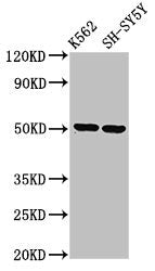 Immunohistochemistry of paraffin-embedded human small intestine tissue using CAC09689 at dilution of 1:100
