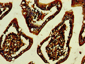 Gpa33 Polyclonal Antibody - image 4