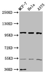 Immunohistochemistry of paraffin-embedded human small intestine tissue using CAC09690 at dilution of 1:100
