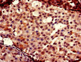 Foxc2 Polyclonal Antibody - image 3
