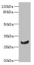 Immunohistochemistry of paraffin-embedded human thyroid tissue using CAC09713 at dilution of 1:100