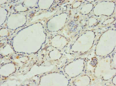 C11Orf68 Polyclonal Antibody - image 3