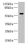 Immunohistochemistry of paraffin-embedded human skin tissue using CAC09722 at dilution of 1:100