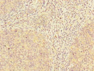 Adat1 Polyclonal Antibody - image 4