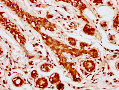 Immunofluorescence staining of HepG2 cells with CAC09782 at 1:333, counter-stained with DAPI. The cells were fixed in 4% formaldehyde, permeabilized using 0.2% Triton X-100 and blocked in 10% normal Goat Serum. The cells were then incubated with the antibody overnight at 4°C. The secondary antibody was Alexa Fluor 488-congugated AffiniPure Goat Anti-Rabbit IgG(H+L).