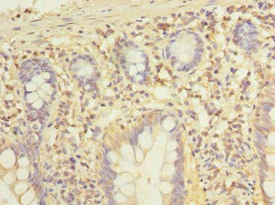 Immunofluorescent analysis of Hela cells using CAC09786 at dilution of 1:100 and Alexa Fluor 488-congugated AffiniPure Goat Anti-Rabbit IgG(H+L)