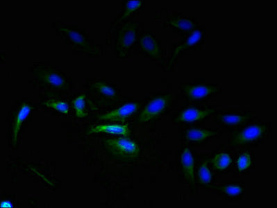 Adgrl4 Polyclonal Antibody - image 4