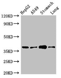 Immunofluorescent analysis of A549 cells using CAC09818 at dilution of 1:100 and Alexa Fluor 488-congugated AffiniPure Goat Anti-Rabbit IgG(H+L)