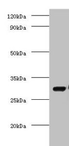 Immunohistochemistry of paraffin-embedded human adrenal gland tissue using CAC09835 at dilution of 1:100