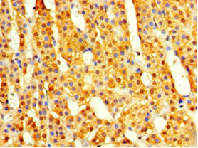 Immunohistochemistry of paraffin-embedded human placenta tissue using CAC09835 at dilution of 1:100