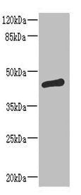 St6Galnac2 Polyclonal Antibody - image 2
