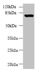 Immunohistochemistry of paraffin-embedded human adrenal gland tissue using CAC09872 at dilution of 1:100