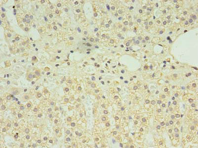 Clpb Polyclonal Antibody - image 3