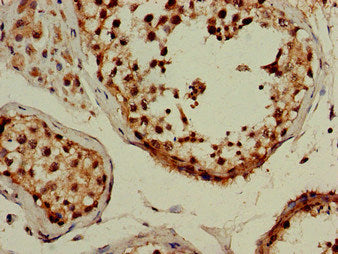 Map1Lc3B Polyclonal Antibody - image 2