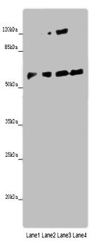 Immunohistochemistry of paraffin-embedded human tonsil tissue using CAC09935 at dilution of 1:100