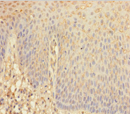 Immunohistochemistry of paraffin-embedded human heart tissue using CAC09935 at dilution of 1:100
