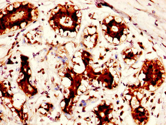 Immunofluorescence staining of Hela cells with CAC09963 at 1:100, counter-stained with DAPI. The cells were fixed in 4% formaldehyde, permeabilized using 0.2% Triton X-100 and blocked in 10% normal Goat Serum. The cells were then incubated with the antibody overnight at 4°C. The secondary antibody was Alexa Fluor 488-congugated AffiniPure Goat Anti-Rabbit IgG(H+L).