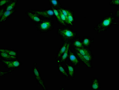 Padi2 Polyclonal Antibody - image 4
