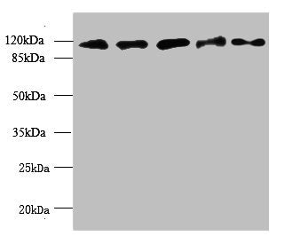 Immunohistochemistry of paraffin-embedded human testis tissue using CAC09966 at dilution of 1:100