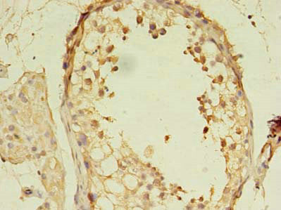 Morc2 Polyclonal Antibody - image 3