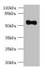 Immunohistochemistry of paraffin-embedded human thyroid tissue using CAC09989 at dilution of 1:100