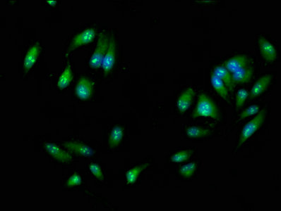 Ripk3 Polyclonal Antibody - image 4