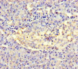 Amtn Polyclonal Antibody - image 2