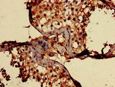 Immunofluorescence staining of PC-3 cells with CAC10357 at 1:133, counter-stained with DAPI. The cells were fixed in 4% formaldehyde, permeabilized using 0.2% Triton X-100 and blocked in 10% normal Goat Serum. The cells were then incubated with the antibody overnight at 4°C. The secondary antibody was Alexa Fluor 488-congugated AffiniPure Goat Anti-Rabbit IgG(H+L).