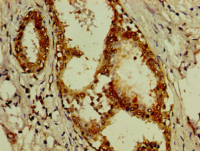 Immunofluorescence staining of A549 cells with CAC10364 at 1:66, counter-stained with DAPI. The cells were fixed in 4% formaldehyde, permeabilized using 0.2% Triton X-100 and blocked in 10% normal Goat Serum. The cells were then incubated with the antibody overnight at 4°C. The secondary antibody was Alexa Fluor 488-congugated AffiniPure Goat Anti-Rabbit IgG(H+L).