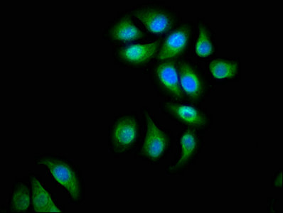 Actn4 Polyclonal Antibody - image 5