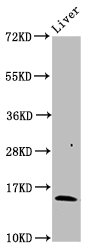 IHC image diluted at 1:300 and staining in paraffin-embedded human placenta tissue performed on a Leica BondTM system. After dewaxing and hydration, antigen retrieval was mediated by high pressure in a citrate buffer (pH 6.0). Section was blocked with 10% normal goat serum 30min at RT. Then primary antibody (1% BSA) was incubated at 4°C overnight. The primary is detected by a biotinylated secondary antibody and visualized using an HRP conjugated SP system.