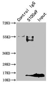 S100A9 Polyclonal Antibody - image 3
