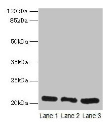 Immunohistochemistry of paraffin-embedded human tonsil tissue using CAC10387 at dilution of 1:100