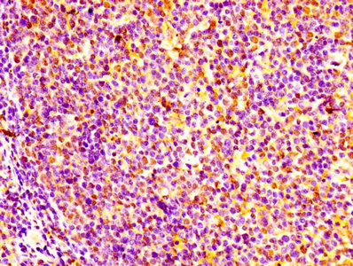 Immunohistochemistry of paraffin-embedded human kidney tissue using CAC10387 at dilution of 1:100